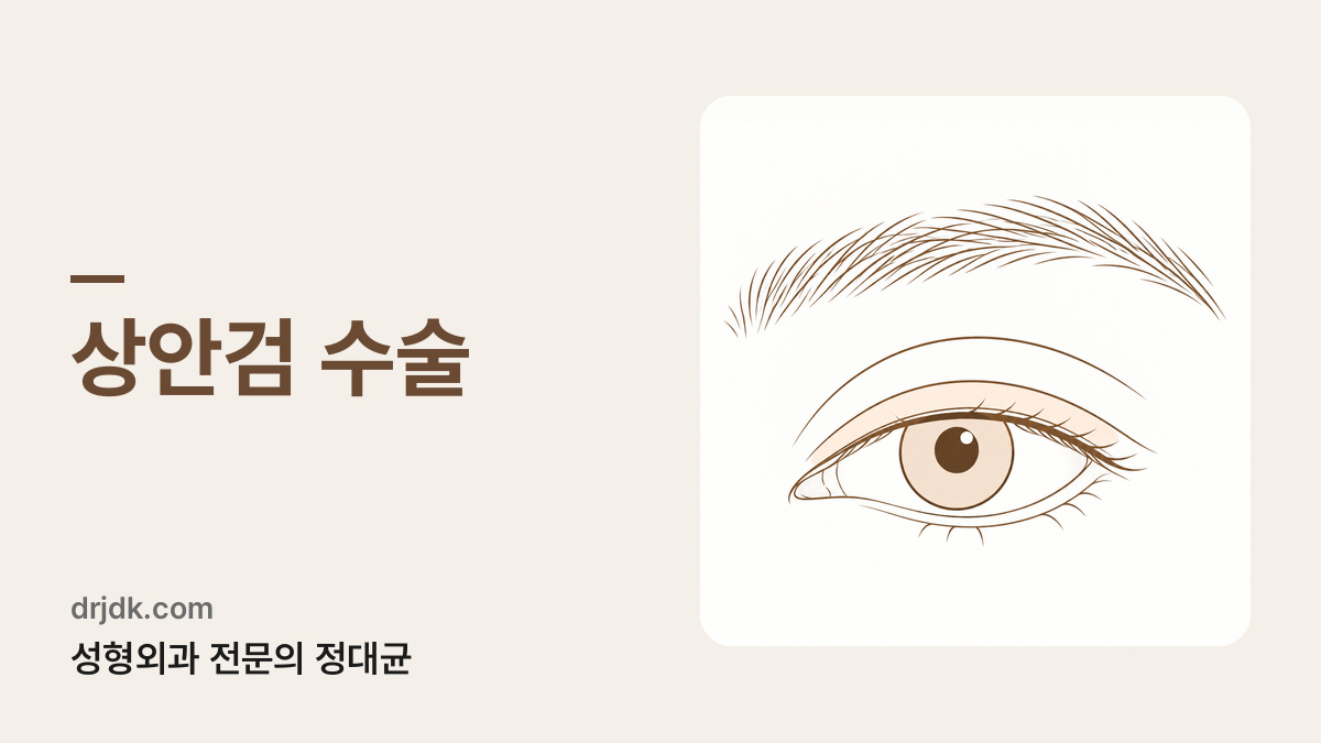 윗눈꺼풀 부위를 표시한 눈 그림